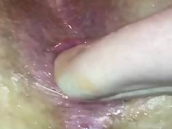 3 min - Closeup gaping anus fisted